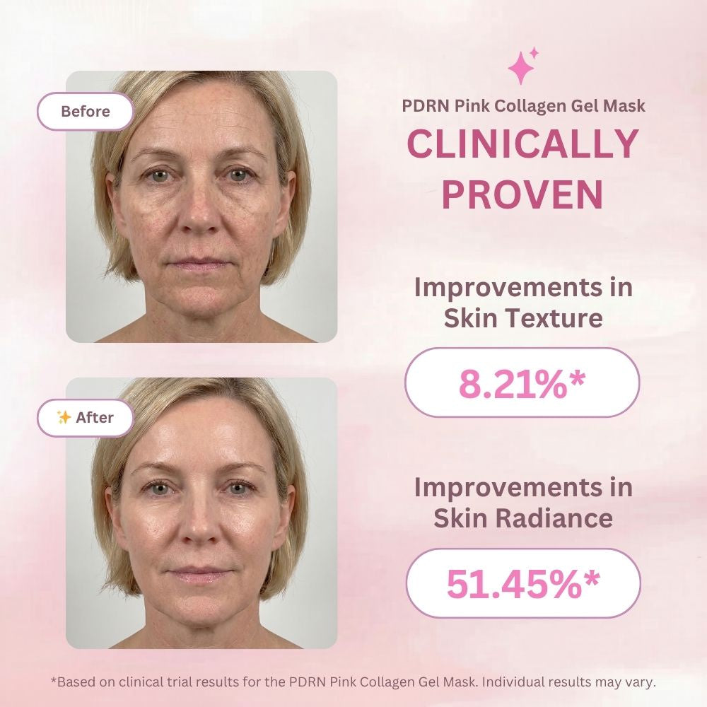 Before and after comparison of a woman's face with PDRN Pink Collagen Gel Mask, showing improvements in skin texture and radiance.