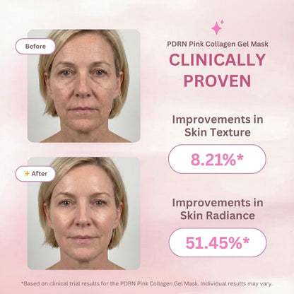 Before and after comparison of a woman's face with PDRN Pink Collagen Gel Mask, showing improvements in skin texture and radiance.